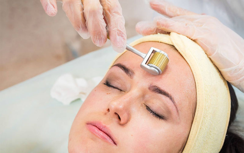 What is Microneedling