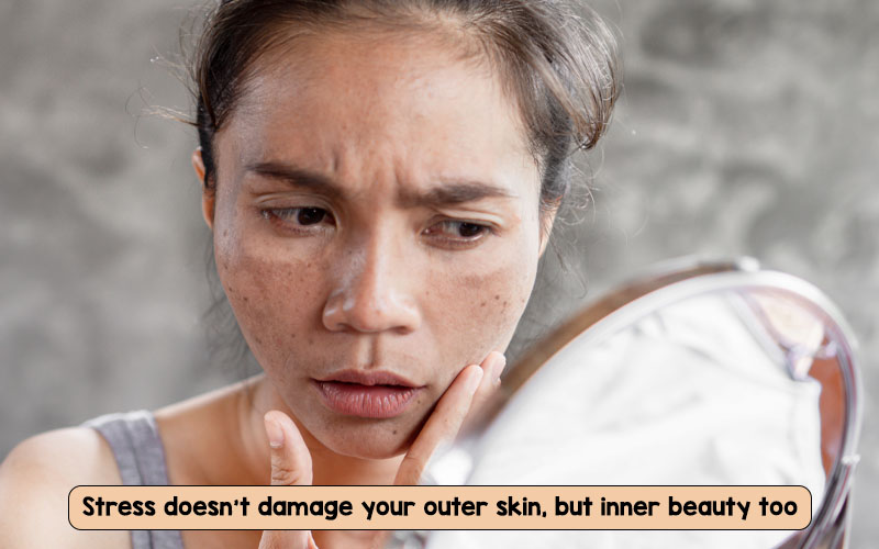 Sallow skin causes