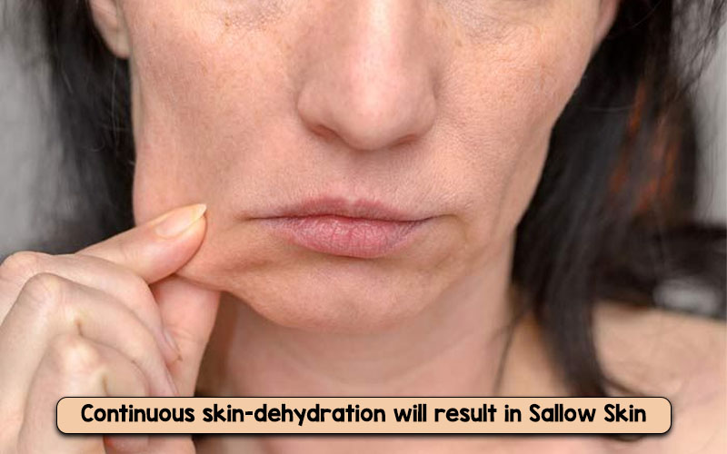 Sallow skin examples