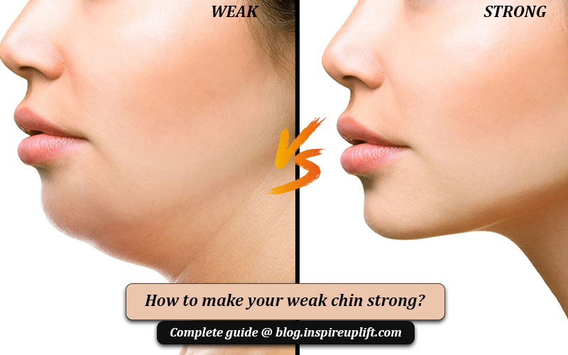 Weak chin shapes image