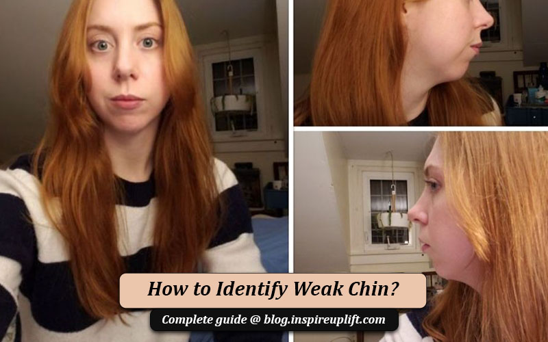 weak chin pictures