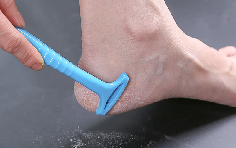 Foot Callus Remover