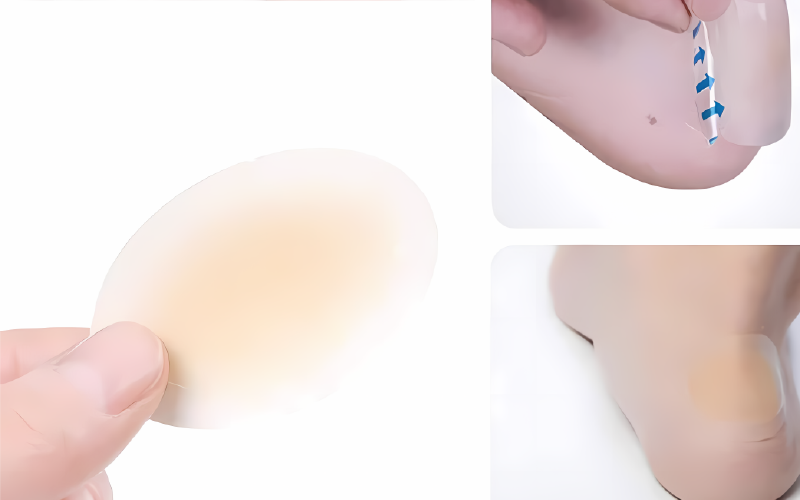 blister patches